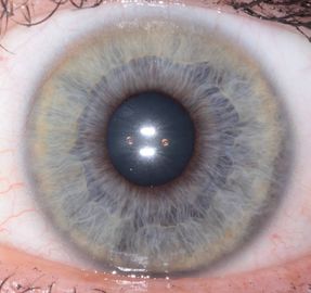 携帯用セリウムの健康のための手持ち型の目のアイリス走査器の検光子は検出します