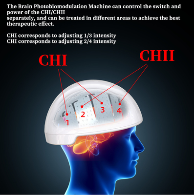 Rtms療法の頭脳のヘルメットのTranscranial磁気刺激物Photobiomodulation
