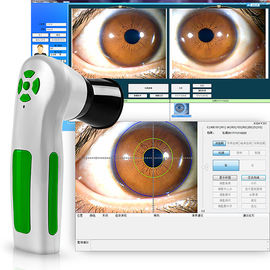 医学の検光子の物理療法の器具12のMegapixelの目のIridologyのカメラ装置