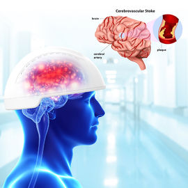 外傷性の脳損傷の頭脳のPhotobiomodulation装置810nm波長