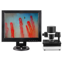血の毛管Microcirculationの顕微鏡600Xの拡大DC12V 2Aの出力