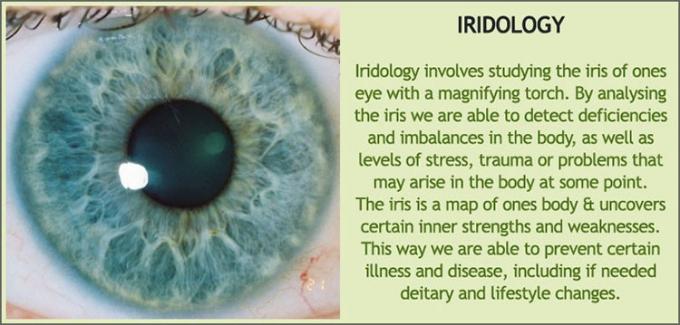 iridologyのアイリス診断