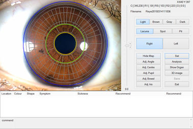 携帯用セリウムの健康のための手持ち型の目のアイリス走査器の検光子は検出します