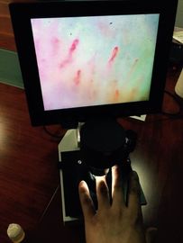 セリウム釘の点検のための公認 OEM LCD スクリーン色の Microcirculation の顕微鏡